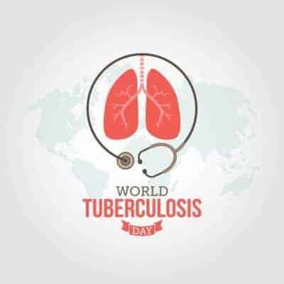 tuberculosis TB - Medical Supply Company