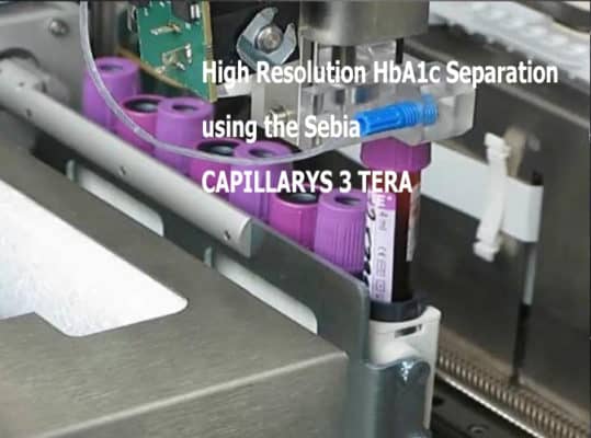 HbA1c Separation using the Sebia CAPILLARYS 3 TERA | Medical Supply Company