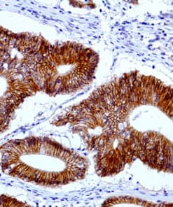 Beta-Catenin (EP35) Rabbit Monoclonal Antibody
