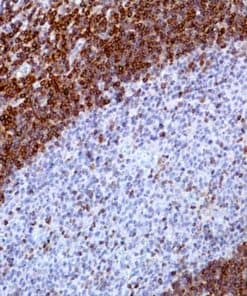 Bcl-2 (EP36) Rabbit Monoclonal Antibody
