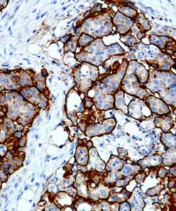 CA 125 (EP48) Rabbit Monoclonal Antibody