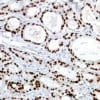 Androgen Receptor (EP120) Rabbit Monoclonal Antibody