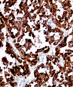 Calcitonin (EP92) Rabbit Monoclonal Antibody