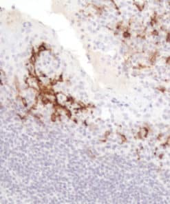 Aldh1A1 (EP168) Rabbit Monoclonal Antibody