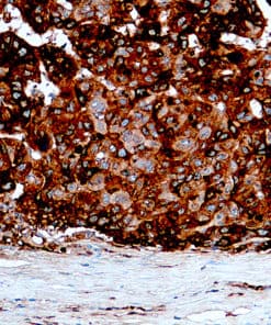 AFP (EP209) Rabbit Monoclonal Antibody