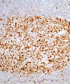 Bcl-6 (EP278) Rabbit Monoclonal Antibody