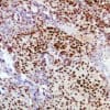 ARID1A (BAF250a) (EP303) Rabbit Monoclonal Antibody