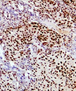 ARID1A (BAF250a) (EP303) Rabbit Monoclonal Antibody