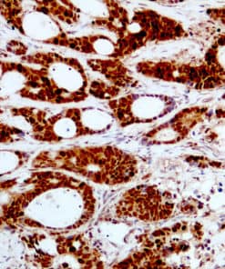 Beclin-1 (EP304) Rabbit Monoclonal Antibody