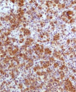 ALK (EP302) Rabbit Monoclonal Antibody