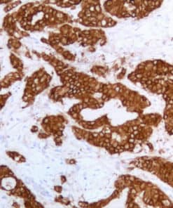 Anterior Gradient 2 (AGR2) (EP329) Rabbit Monoclonal Antibody
