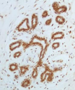 ATM (EP327) Rabbit Monoclonal Antibody