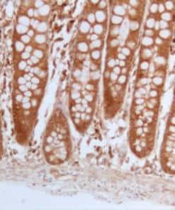 BAD (EP315) Rabbit Monoclonal Antibody