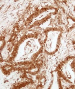 Annexin VII (EP367) Rabbit Monoclonal Antibody