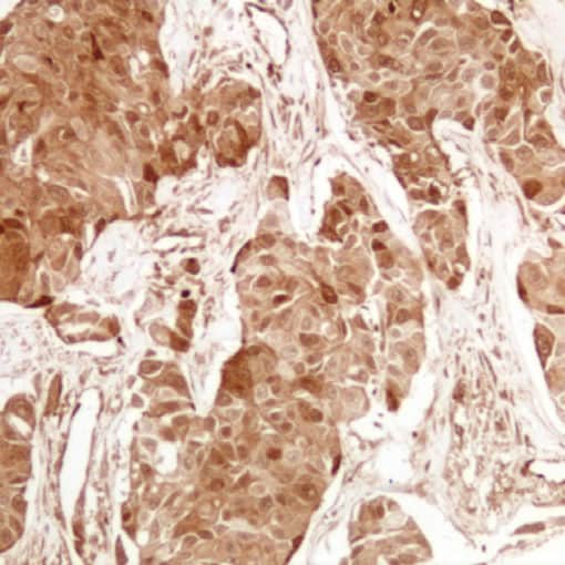 4E-BP1 (EP352) Rabbit Monoclonal Antibody