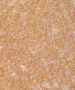ARD1 (EP357) Rabbit Monoclonal Antibody