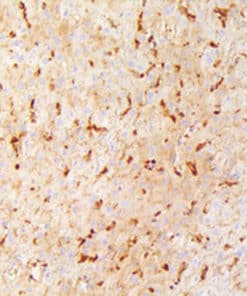 A-1-Antichymotrypsin (EP384) Rabbit Monoclonal Antibody