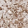 CD61 (GPIIIa) (EP65) Rabbit Monoclonal Antibody