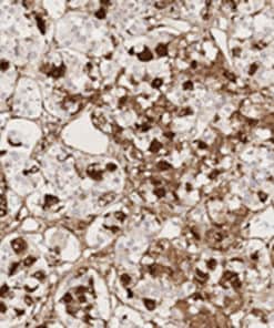 CD61 (GPIIIa) (EP65) Rabbit Monoclonal Antibody