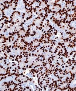 Androgen Receptor (SP107) Rabbit Monoclonal Antibody