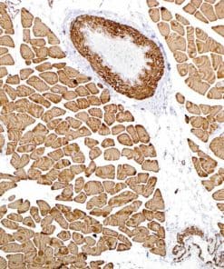 Actin, Muscle Specific (HHF35) Mouse Monoclonal Antibody