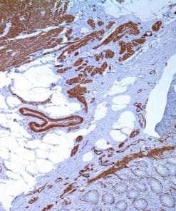 Actin, Smooth Muscle (1A4) Mouse Monoclonal Antibody