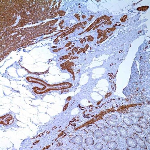 Actin, Smooth Muscle (1A4) Mouse Monoclonal Antibody