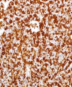 Alpha-Fetoprotein Rabbit Polyclonal Antibody