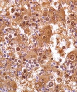 Alpha-Fetoprotein (EP209) Rabbit Monoclonal Antibody