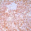 ALK Protein (ALK-1) Mouse Monoclonal Antibody