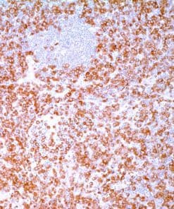 ALK Protein (ALK-1) Mouse Monoclonal Antibody