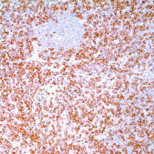 ALK Protein (ALK-1) Mouse Monoclonal Antibody
