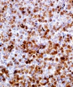 Annexin A1 (MRQ-3) Mouse Monoclonal Antibody