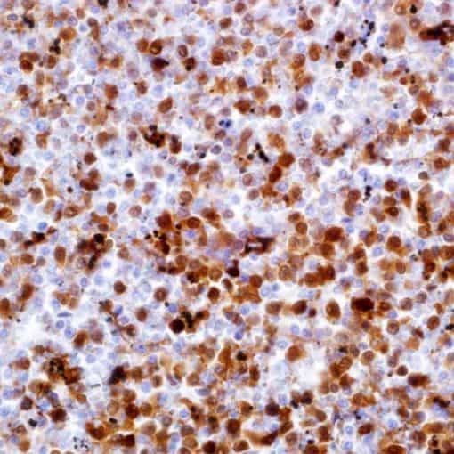 Annexin A1 (MRQ-3) Mouse Monoclonal Antibody