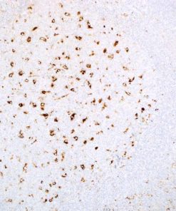 A-1-Antichymotrypsin Rabbit Polyclonal Antibody