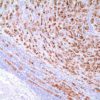 BCA-225 (Cu-18) Mouse Monoclonal Antibody