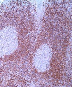 BCL2 (124) Mouse Monoclonal Antibody