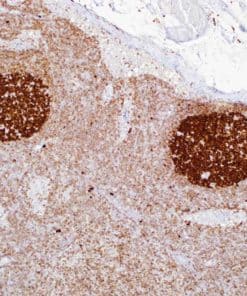 BCL2 (E17) Rabbit Monoclonal Antibody