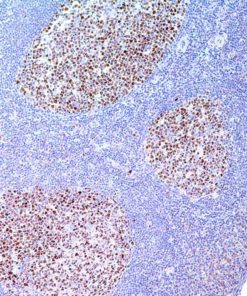 BCL6 (GI191E/A8) Mouse Monoclonal Antibody