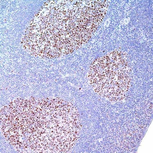 BCL6 (GI191E/A8) Mouse Monoclonal Antibody
