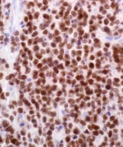 BCL6 (EP278) Rabbit Monoclonal Antibody
