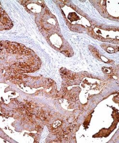 BG8, LewisY (F3) Mouse Monoclonal Antibody
