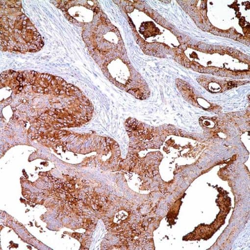 BG8, LewisY (F3) Mouse Monoclonal Antibody