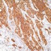 Calcitonin Rabbit Polyclonal Antibody