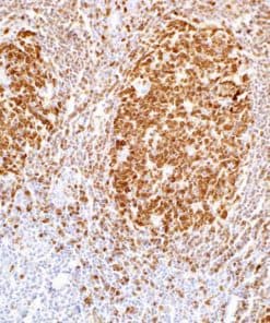 BOB.1 (SP92) Rabbit Monoclonal Antibody