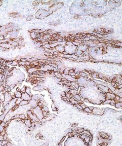 CA-125 (OC125) Mouse Monoclonal Antibody