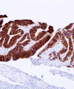 Cadherin-17 (SP183) Rabbit Monoclonal Antibody