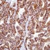Carbonic Anhydrase IX (CA IX) (MRQ-54) Mouse Monoclonal Antibody