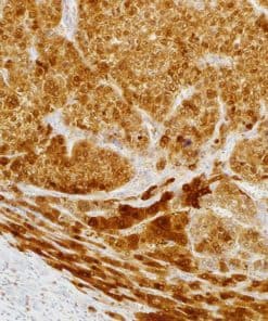Arginase-1 (EP261) Rabbit Monoclonal Antibody