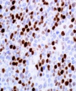c-Myc (EP121) Rabbit Monoclonal Antibody